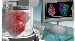 Why 3D Printing Organs Will Be Hard – Difficulties of Bioprinting