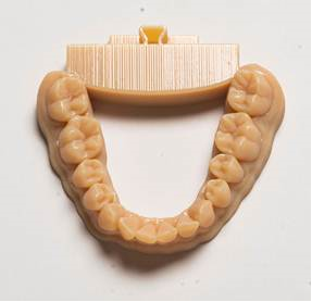 3D-Printing Dental Market