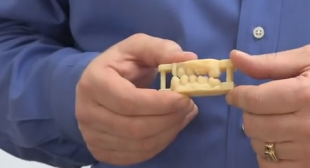3D Printing Dental Milling – 3D Printing Gives Dental Labs the Ability to Compete